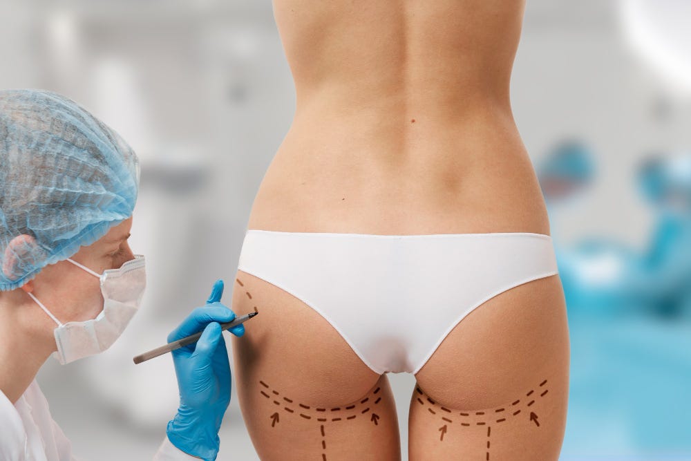 What Areas of the Body Can Liposuction Treat? - Cosmos Clinic